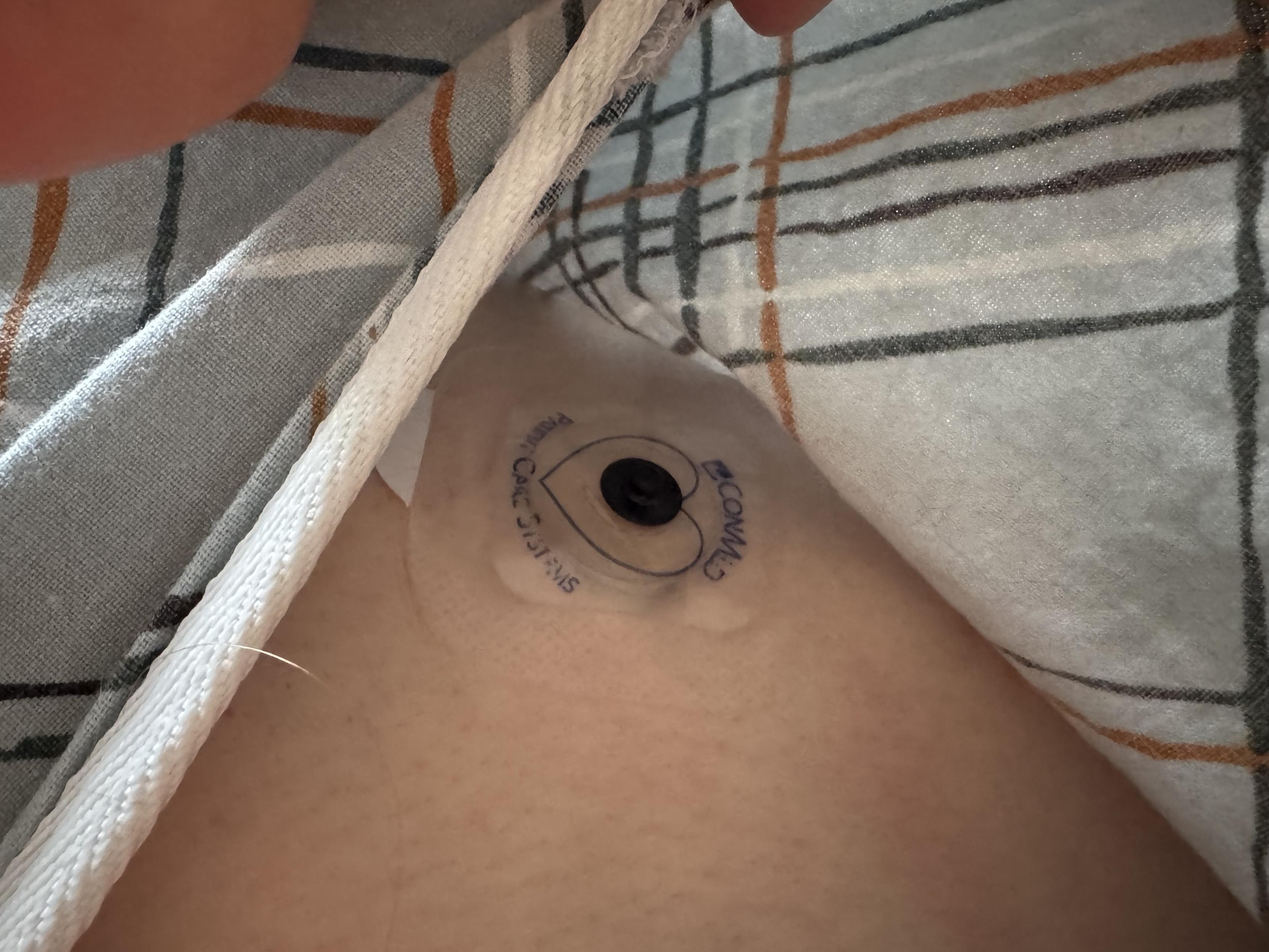 an EKG patch on my upper chest.